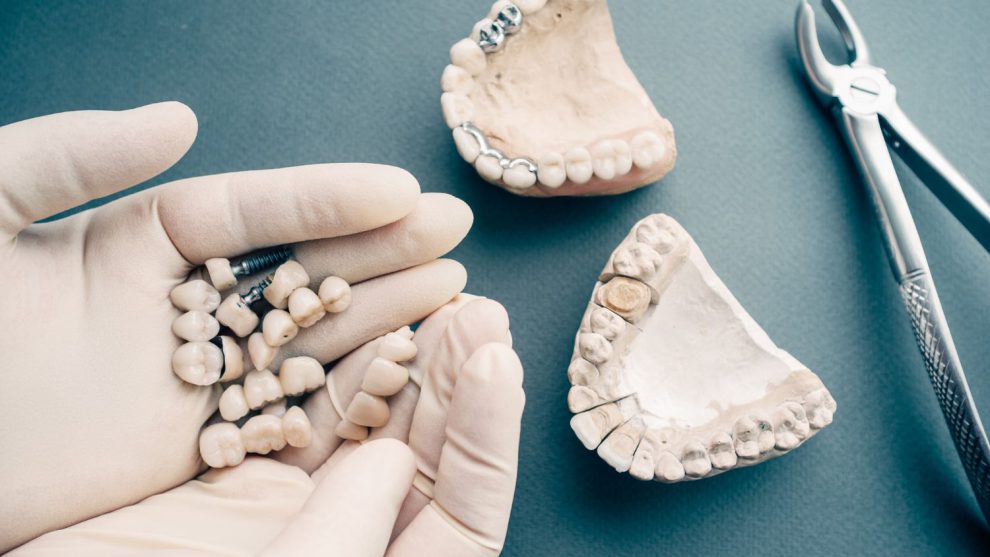 Uzyskaj olśniewający uśmiech: Nowoczesne protezy zębowe w Poznaniu